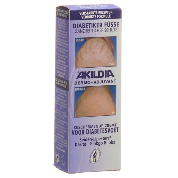 AKILDIA Schutzcreme 75 ml